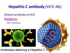 Hepatitis C Antibody Test - Hepatitis C Treatment