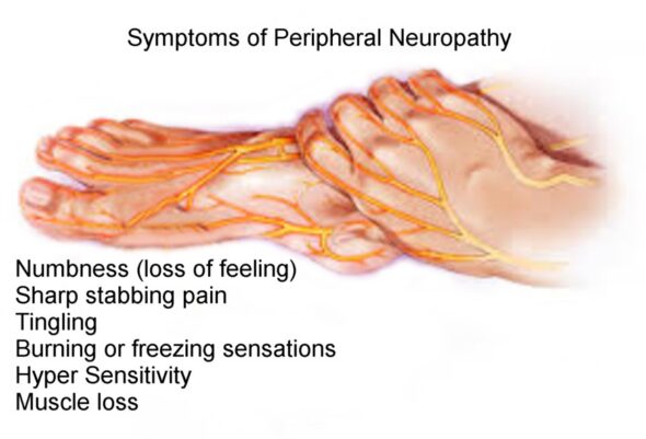 Hep C And Peripheral Neuropathy Hepatitis C Treatment 